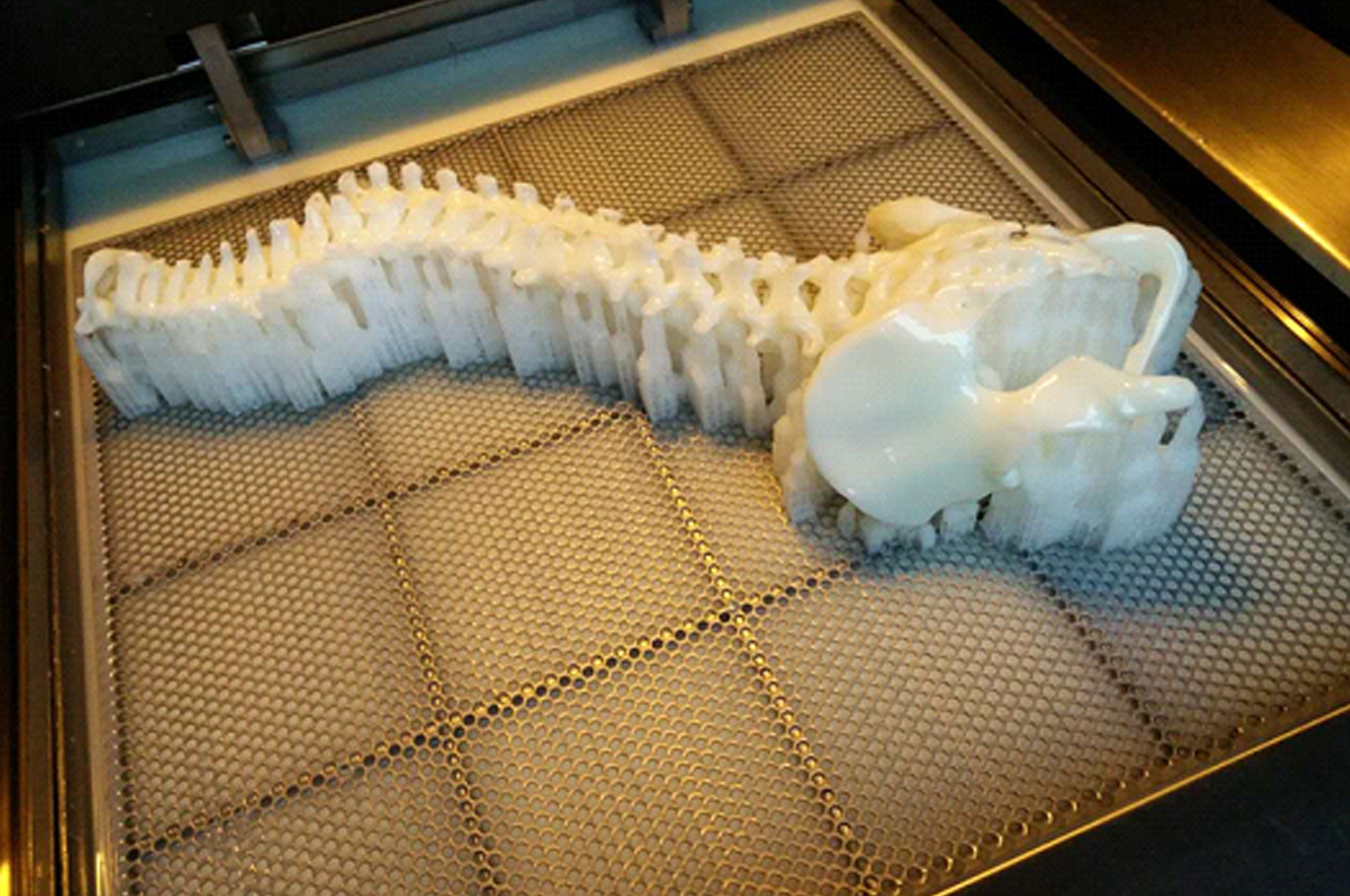 3D打印脊柱