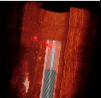 快来看看3D打印出的世界上最小的血管透视镜是什么样的？