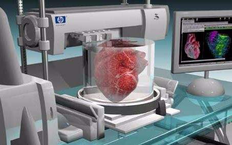 生物3D打印技术辅助治疗，可构建个体化病变模型