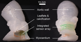 科学家3D打印出逼真的心脏瓣膜模型