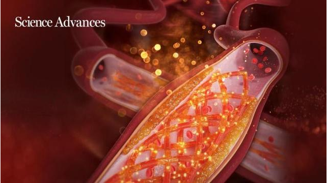 3D打印“聪明”的心血管支架！南科大团队最新研究成果登上《科学》子刊