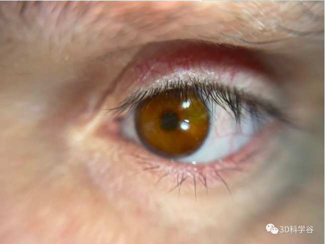 Fraunhofer正在彻底改变眼部假体的3D 打印