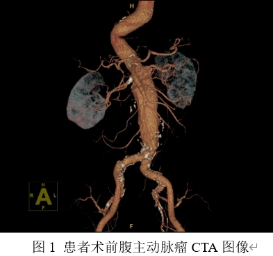 3D打印,山东3D打印,北方3D打印,青岛3D打印,光固化,光敏树脂